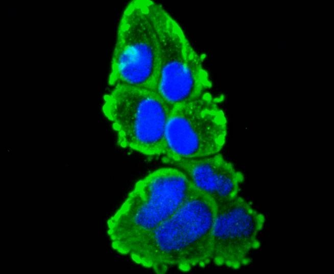 Anti-KRT16 Antibody (3O311)