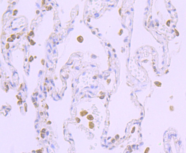 Anti-CYPOR Antibody (2K509)