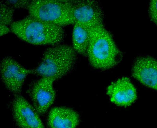 Anti-KRT4 Antibody (5F548)