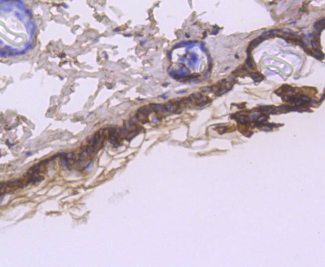 Anti-KRT1 Antibody (8C677)