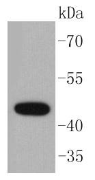 Anti-KRT15 Antibody (3G540)