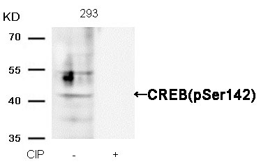 Anti-Phospho-CREB1 (Ser142) Polyclonal Antibody 2