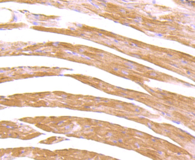 Anti-CXCR5 Antibody (1U955)