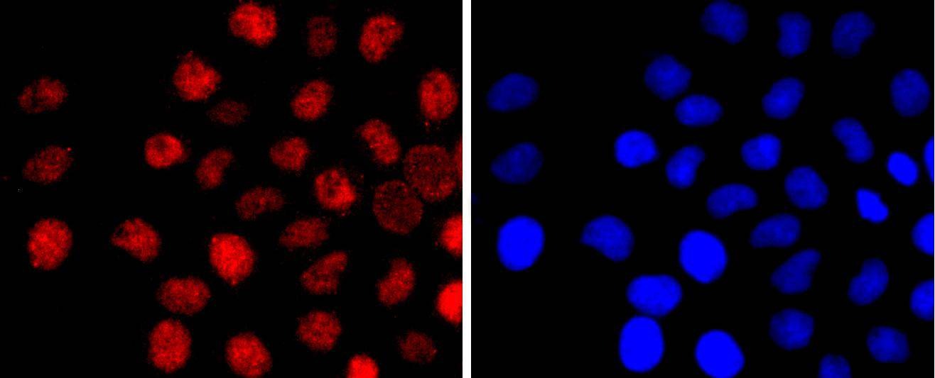 Anti-Ctip2 Antibody (8M731)