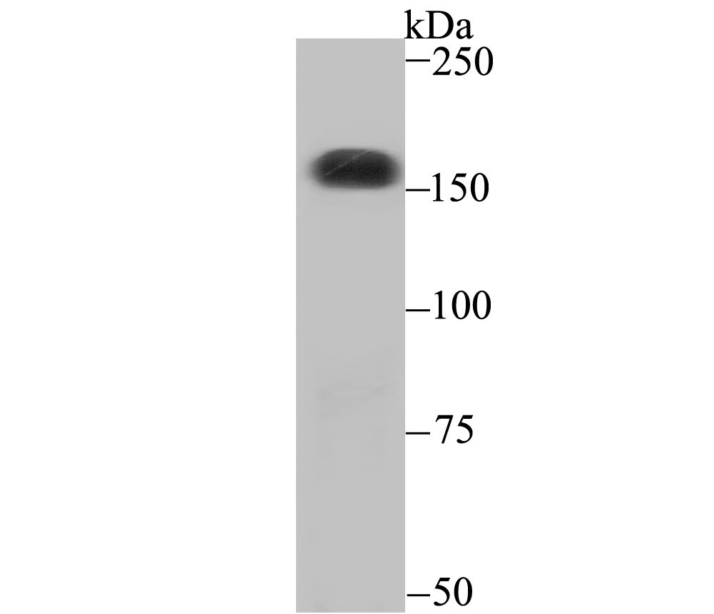 Anti-CPS1 Antibody (3F443)
