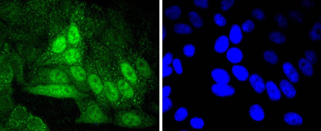 Anti-Cyclin A2 Antibody (9J817)