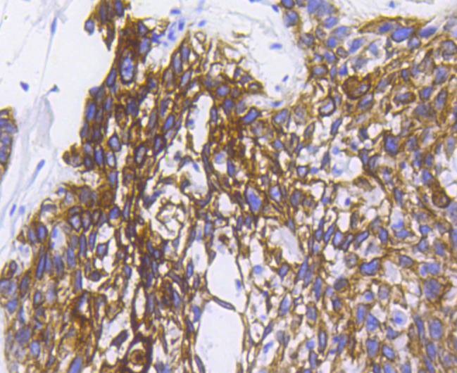 Anti-KRT5 Antibody (6F446)