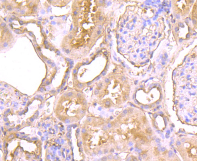 Anti-CTHRC1 Antibody (5Z159)