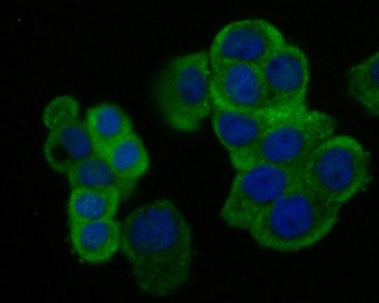 Anti-Creatine kinase B/CKB Antibody (1R5)