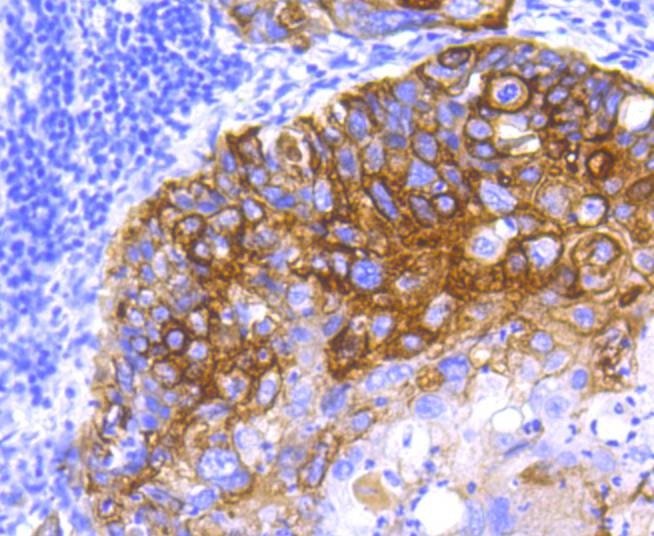 Anti-KRT5 Antibody (6F446)