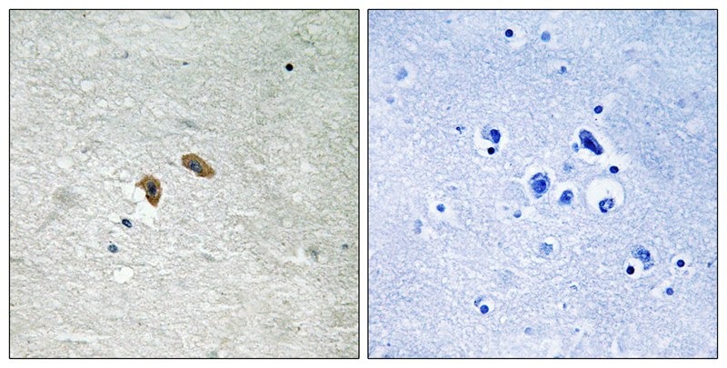 Anti-Phospho-RAF1 (Thr269) Polyclonal Antibody 2