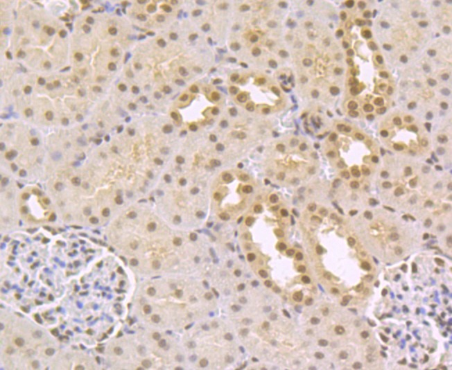 Anti-CtBP1 Antibody (2M770)