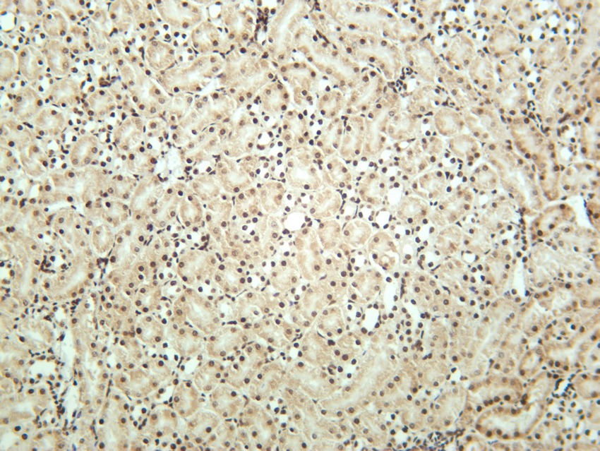 Anti-CTCF Antibody (5J799)