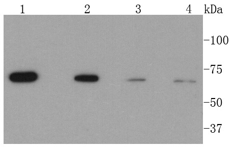 Anti-CPT2 Antibody (3I417)
