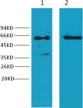 Anti-KRT6A Antibody (5U156)
