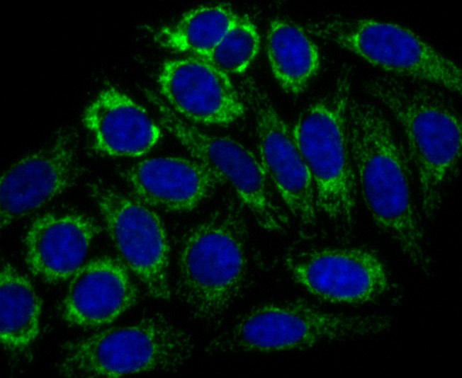 Anti-CPS1 Antibody (3F443)