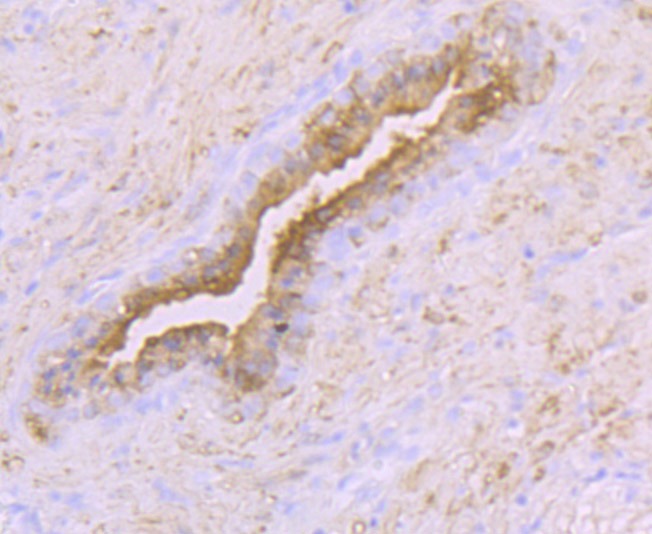 Anti-Creatine kinase B/CKB Antibody (1R5)