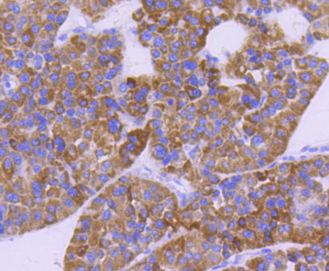 Anti-CPT2 Antibody (3I417)