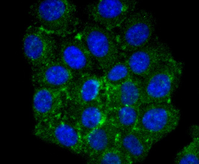Anti-CPT2 Antibody (3I417)