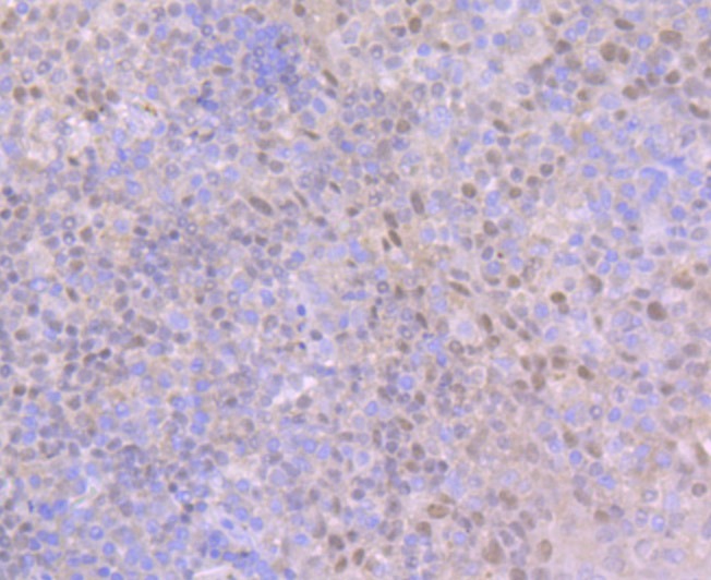 Anti-Ctip1 Antibody (3F515)