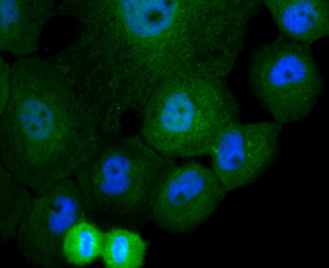 Anti-Cullin 4a Antibody (2X149)