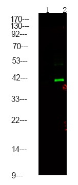 Anti-Phospho-CtBP1/2 (Ser158/164) Polyclonal Antibody