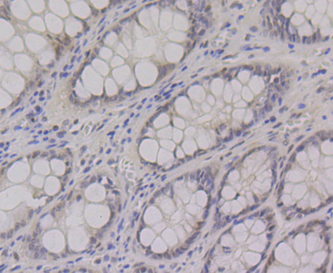 Anti-CtBP1 Antibody (2M770)