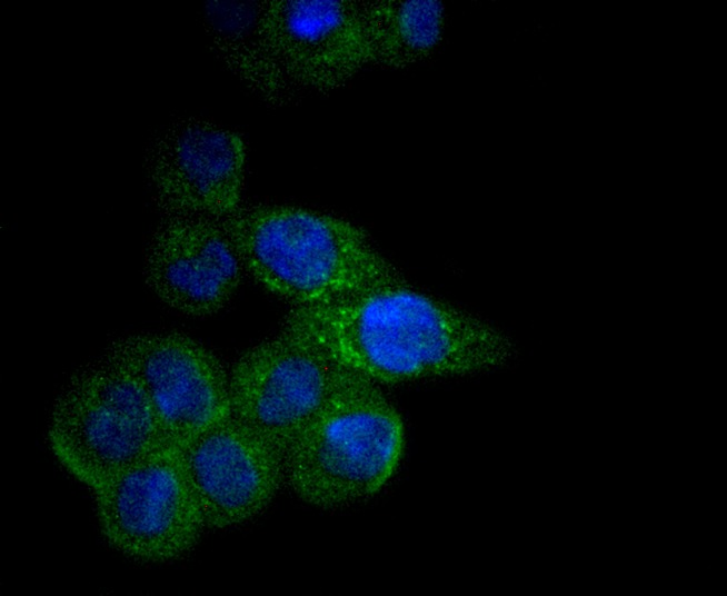 Anti-CPT2 Antibody (3I417)