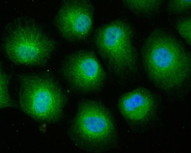 Anti-Cullin 4a Antibody (2X149)