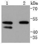 Anti-Cyclin A1/2 Antibody (8Y584)