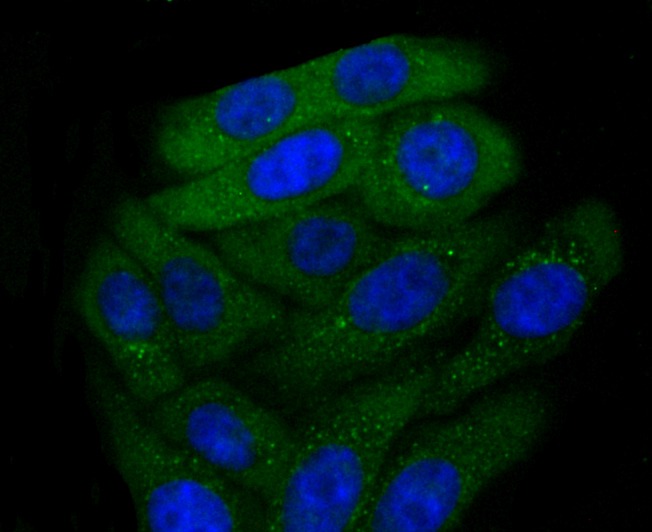 Anti-CXCR3 Antibody (8K493)