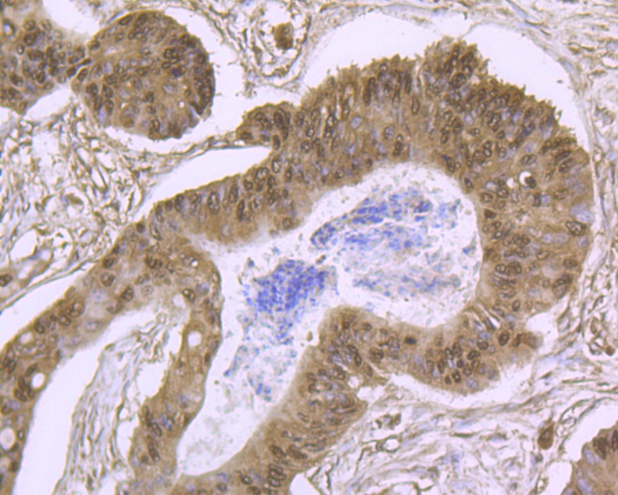 Anti-Cullin 4a Antibody (2X149)
