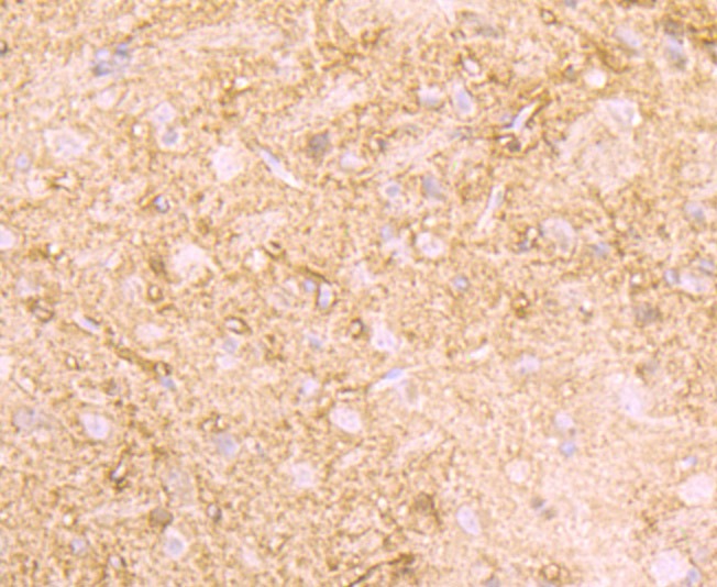 Anti-Creatine kinase B/CKB Antibody (1R5)