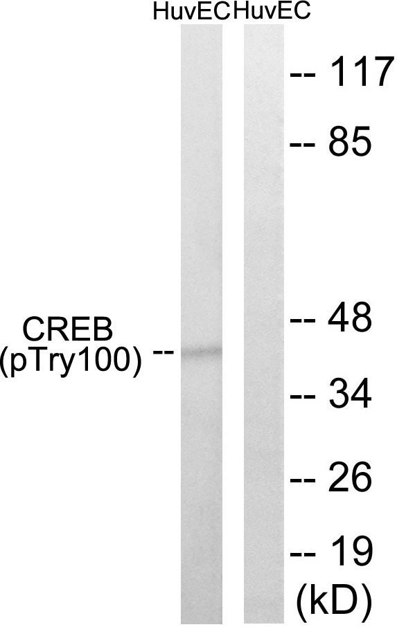 Anti-Phospho-CREB1 (Thr100) Polyclonal Antibody 2