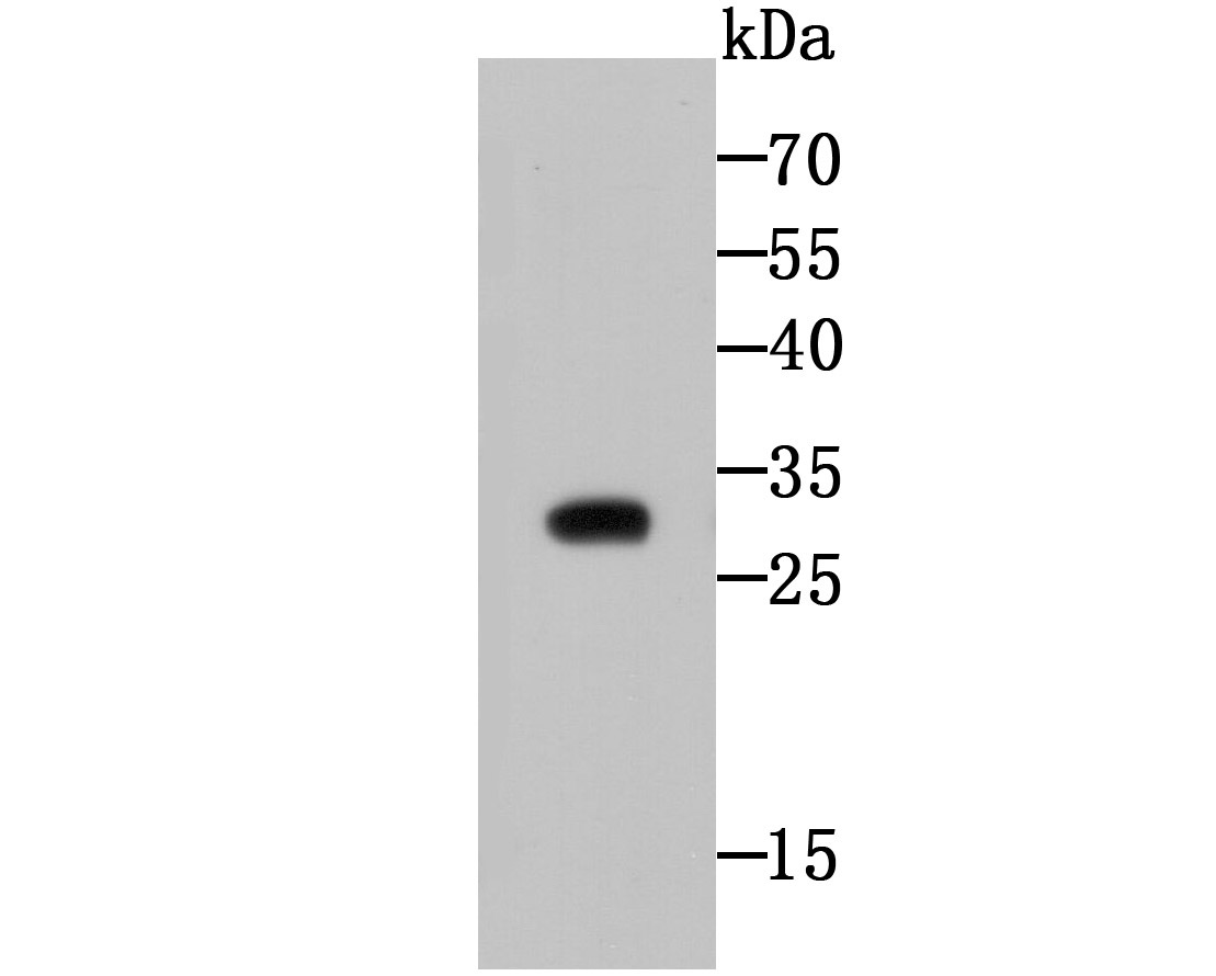 Anti-CTHRC1 Antibody (5Z159)