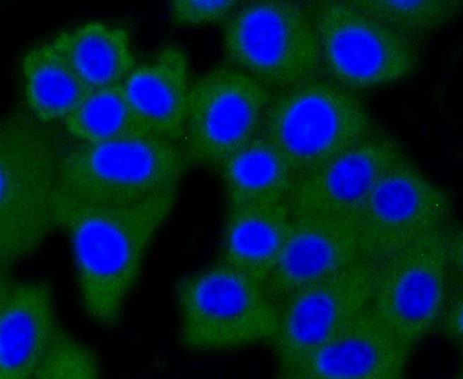 Anti-Dnmt3a Antibody (1X206)
