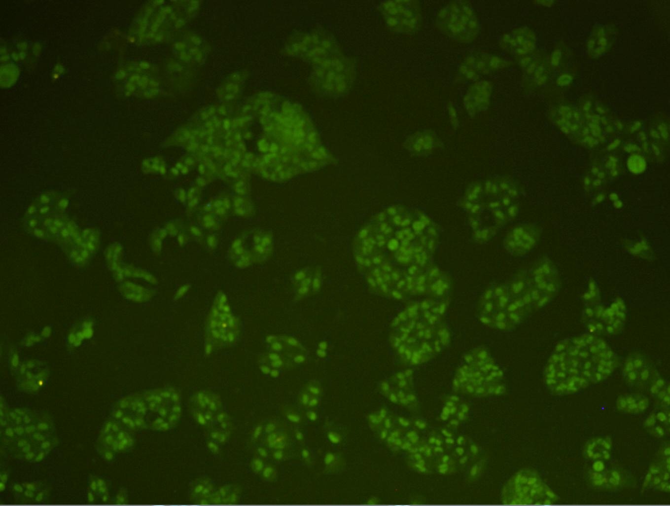 Anti-PRKDC Antibody (4T952)