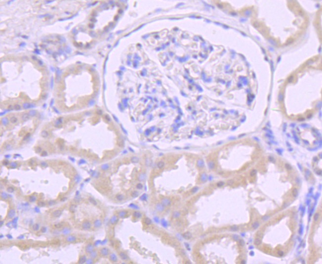 Anti-DKC1 Antibody (9U209)