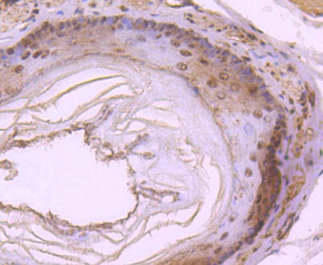 Anti-DYNLL1 Antibody (5G489)
