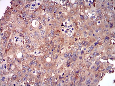 Anti-DIS3L2 Antibody (3M441)