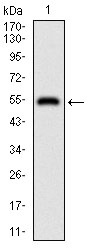 Anti-DIS3L2 Antibody (3M441)