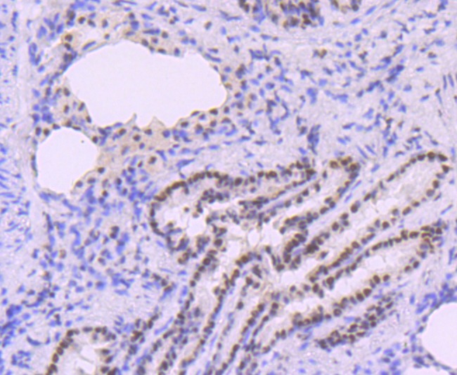 Anti-DNA PolymeraseBeta Antibody (2R73)