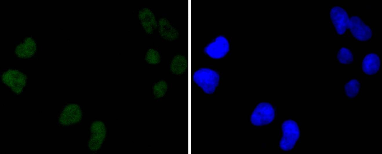 Anti-PRKDC Antibody (5G885)