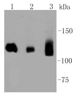 Anti-Dnmt3a Antibody (1X206)