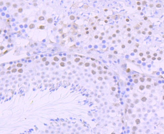 Anti-DKC1 Antibody (9U209)