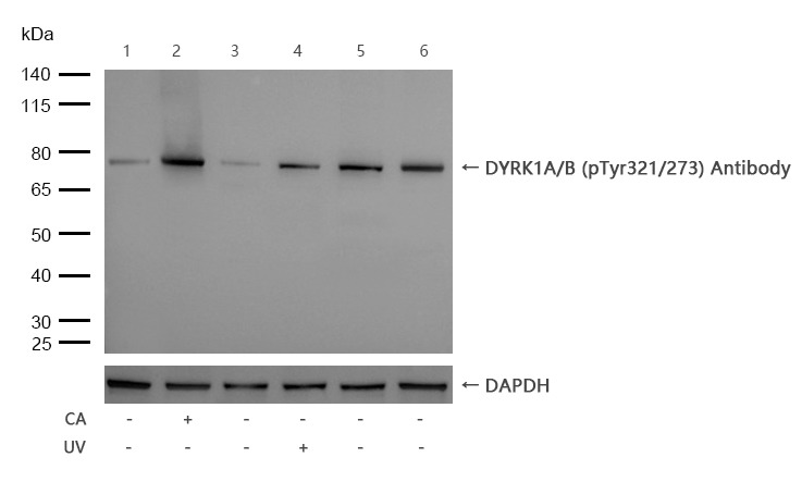 Anti-Phospho-DYRK1A/B (Tyr321/273) Polyclonal Antibody