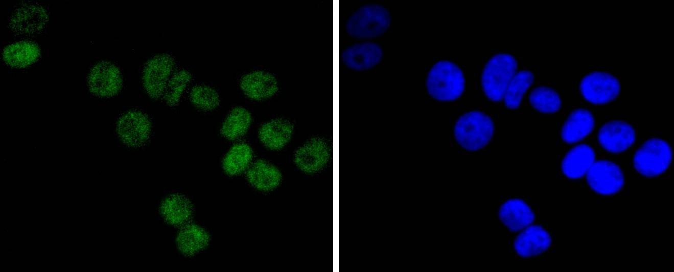 Anti-PRKDC Antibody (5G885)