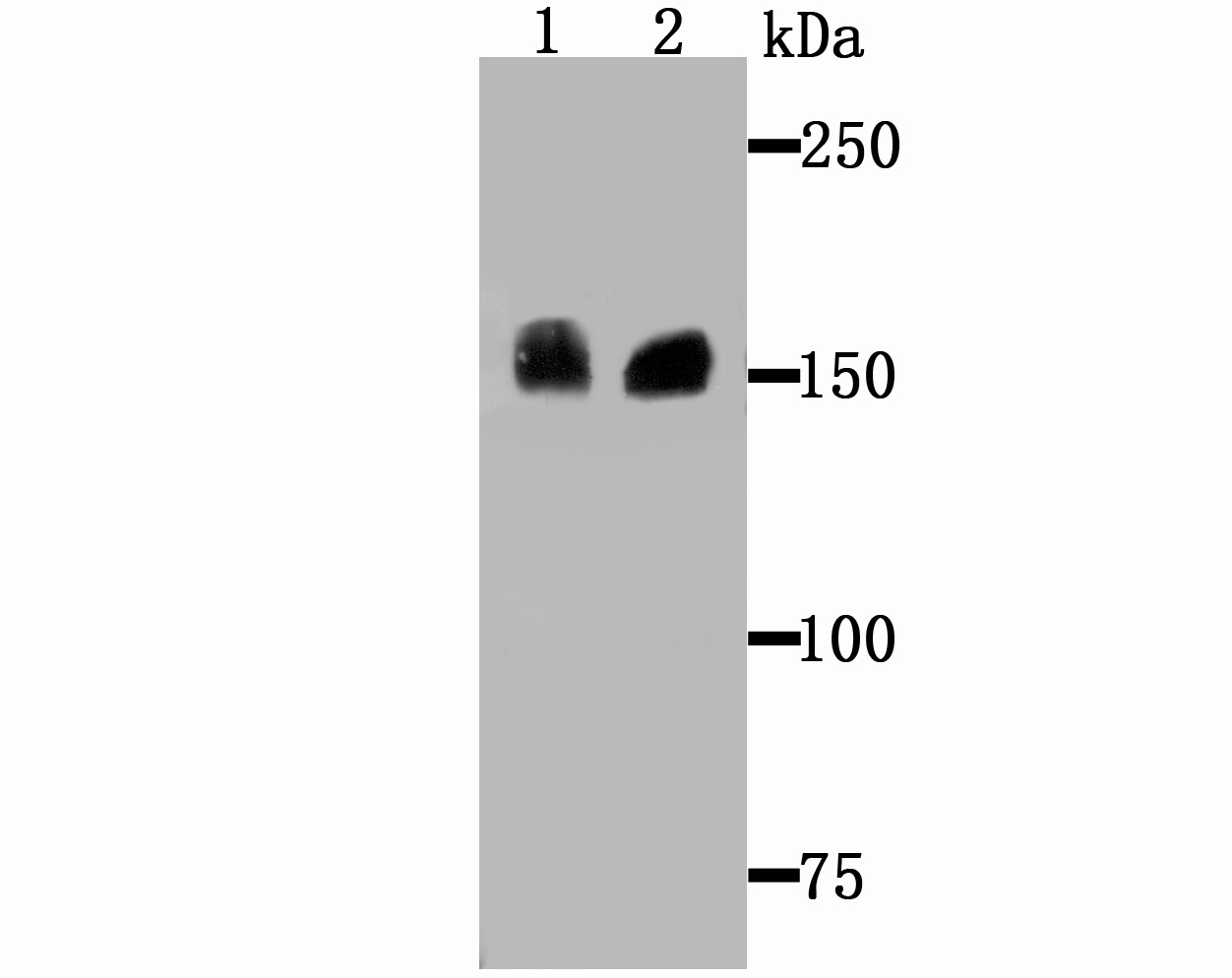 Anti-Drosha Antibody (5J107)