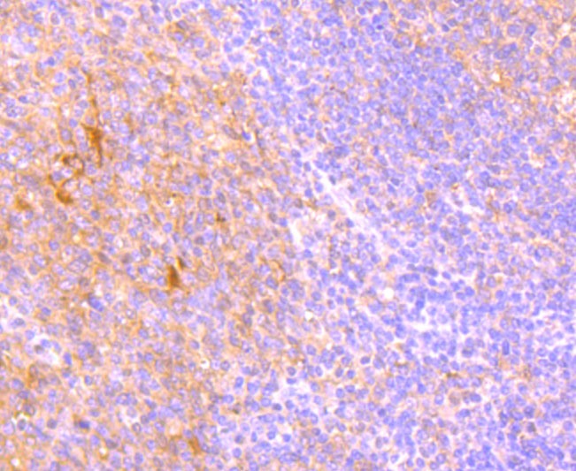 Anti-TRAIL R2/DR5/TNFRSF10B Antibody (7L7)
