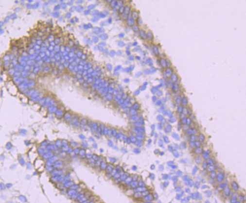 Anti-DSG1 Antibody (4J92)